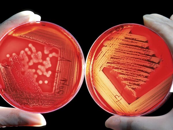 Unveiling the Microscopic Realm: A Journey into Microbiology